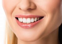 Cosmetic Dentist for Veneers Central HK